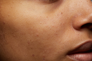 HD Face skin references Darelle Tate cheek skin pores skin…